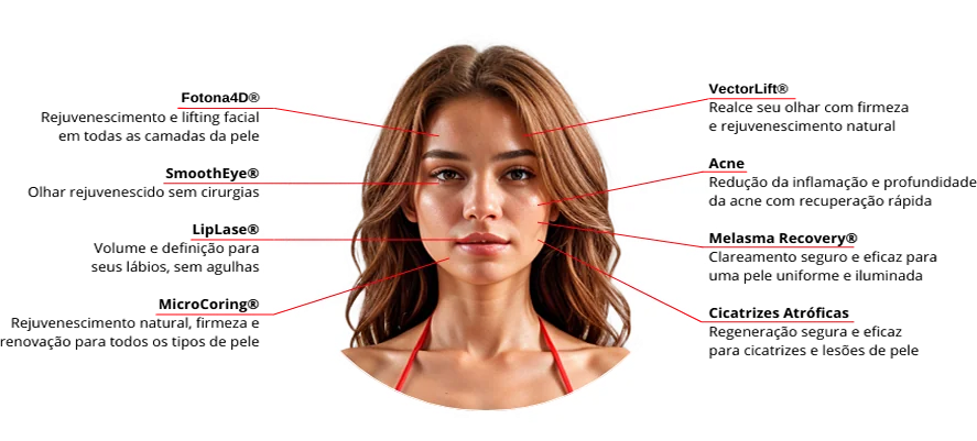 fotona_faciais